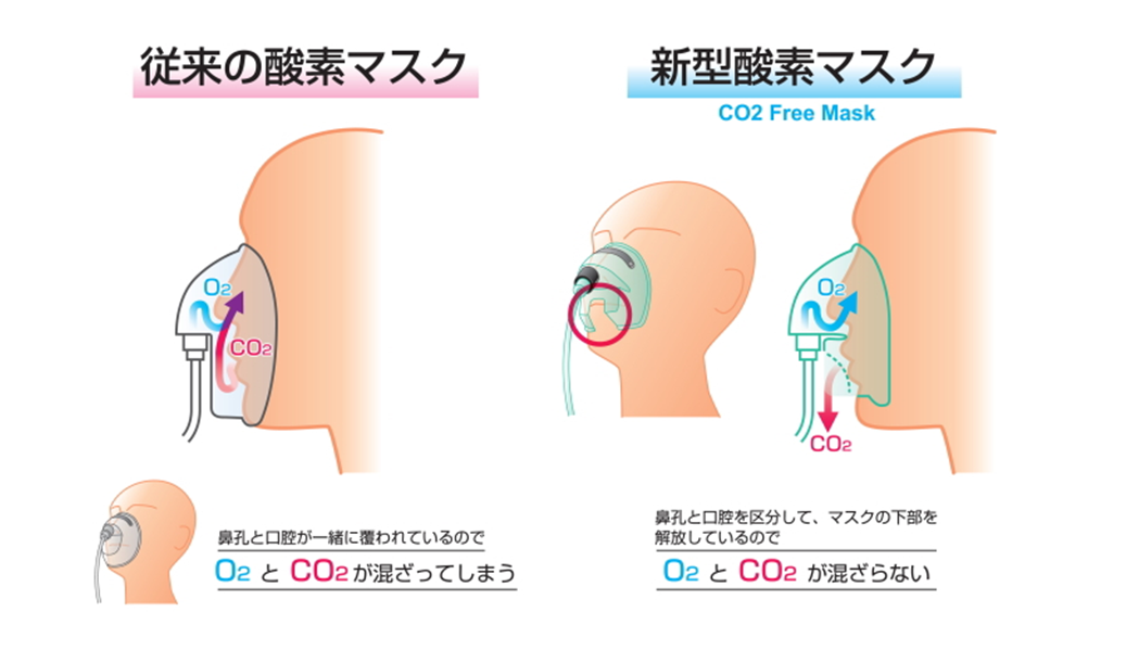 酸素マスクの特徴について