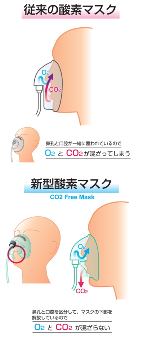酸素マスクの特徴について